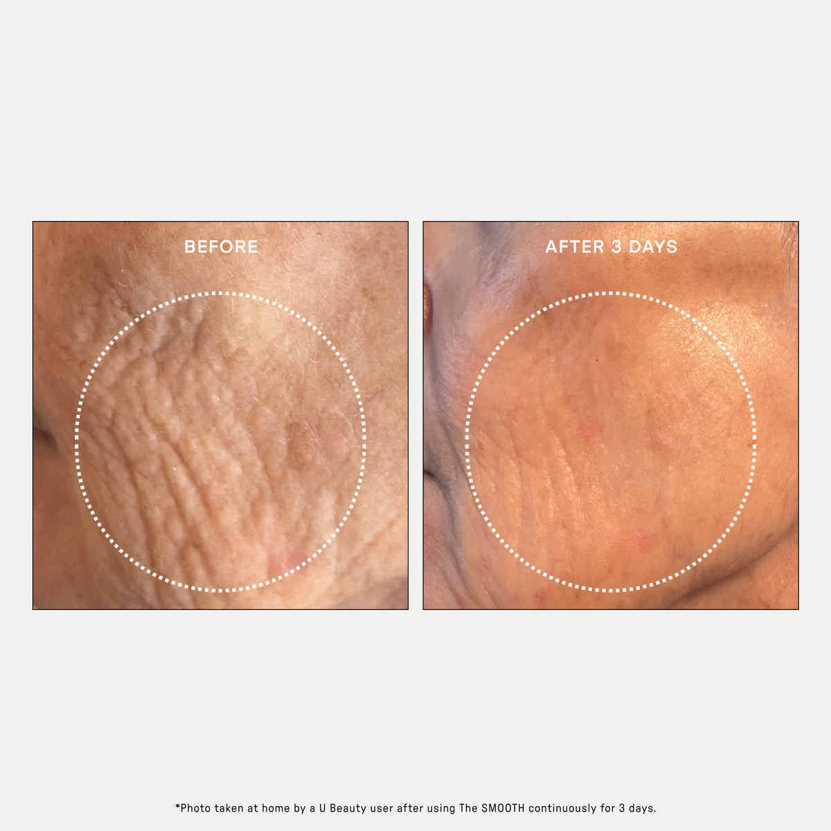 The SMOOTH Dynamic Wrinkle Defense Serum